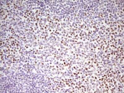 Immunohistochemistry: MEF2D Antibody (OTI1E11) [NBP2-45812]