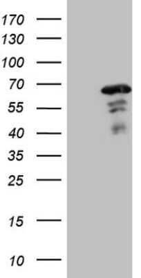 Western Blot: MEF2D Antibody (OTI1E11) [NBP2-45812]