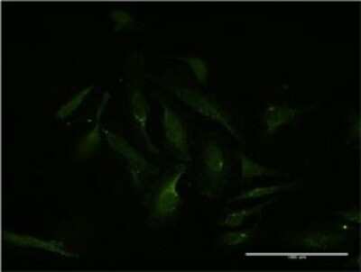 Immunocytochemistry/ Immunofluorescence: MEF2D Antibody (3A11) [H00004209-M02]