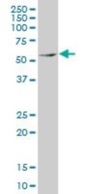 Western Blot: MEF2D Antibody (3A11) [H00004209-M02]