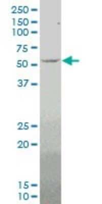 Western Blot: MEF2D Antibody (4D6) [H00004209-M01]