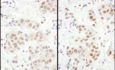 Immunohistochemistry: MEF2D Antibody [NBP1-80566]