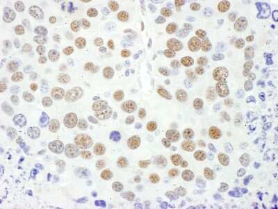 Immunohistochemistry-Paraffin: MEF2D Antibody [NBP1-80567]