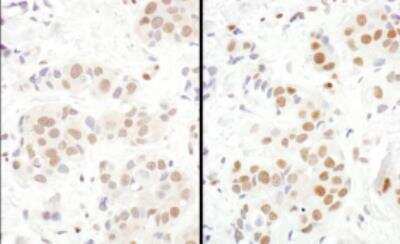 Immunohistochemistry-Paraffin: MEF2D Antibody [NBP1-80567]