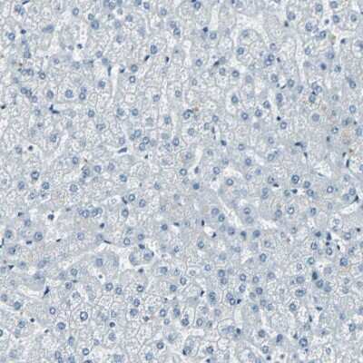 Immunohistochemistry-Paraffin: MEF2D Antibody [NBP1-85788]