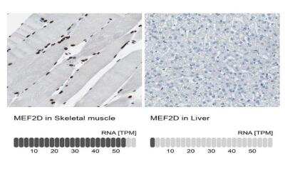 Immunohistochemistry-Paraffin: MEF2D Antibody [NBP1-85788]