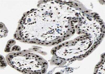 Immunohistochemistry-Paraffin: MEF2D Antibody [NBP1-85788]
