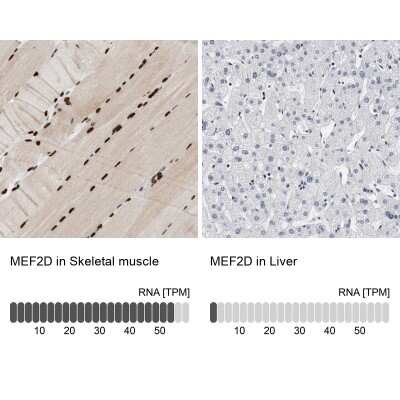 Immunohistochemistry-Paraffin: MEF2D Antibody [NBP1-85795]