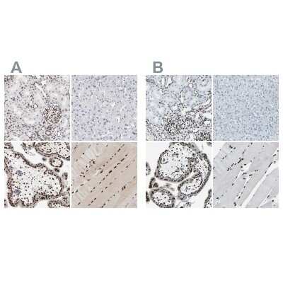 Immunohistochemistry-Paraffin: MEF2D Antibody [NBP1-85795]