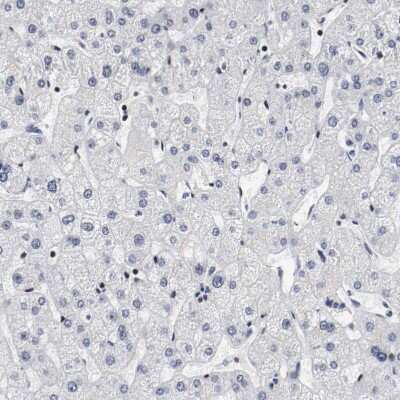 Immunohistochemistry-Paraffin: MEF2D Antibody [NBP1-85795]
