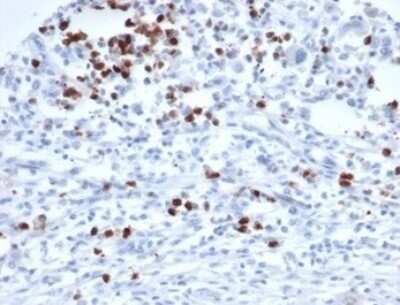 Immunohistochemistry-Paraffin: MEF2D Antibody (PCRP-MEF2D-3A4) [NBP3-13967]