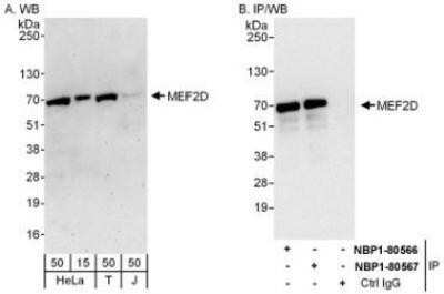 Western Blot: MEF2D Antibody [NBP1-80566]