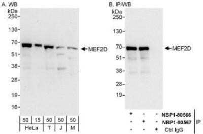 Western Blot: MEF2D Antibody [NBP1-80567]