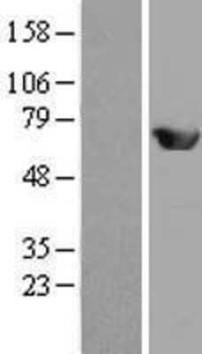 Western Blot: MEF2D Overexpression Lysate [NBL1-13000]