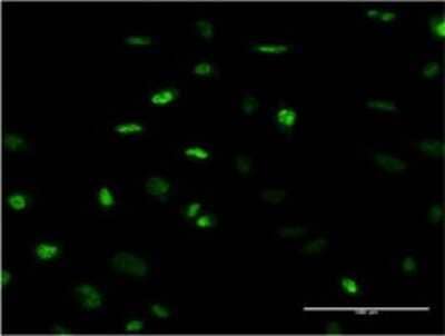 Immunocytochemistry/ Immunofluorescence: MEFV Antibody (2C1) [H00004210-M02]