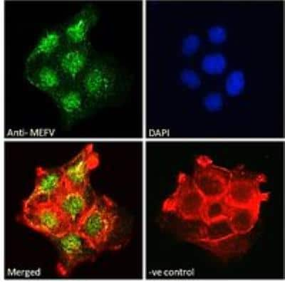 Immunocytochemistry/ Immunofluorescence: MEFV Antibody [NB600-809]