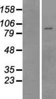 Western Blot: MEFV Overexpression Lysate [NBP2-09044]