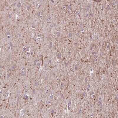 Immunohistochemistry-Paraffin: MEGF8 Antibody [NBP2-14228]