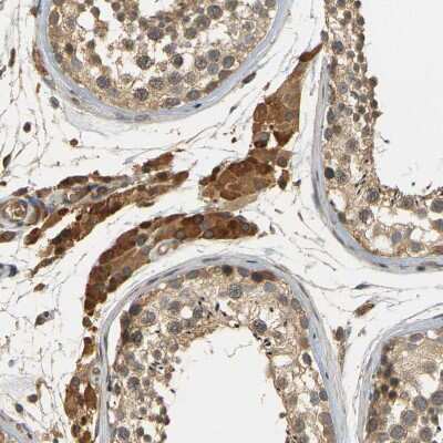 Immunohistochemistry-Paraffin: MEGF9 Antibody [NBP1-84886]