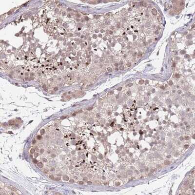 Immunohistochemistry-Paraffin: MEI1 Antibody [NBP2-14229]