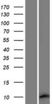 Western Blot: MEIG1 Overexpression Lysate [NBP2-08411]