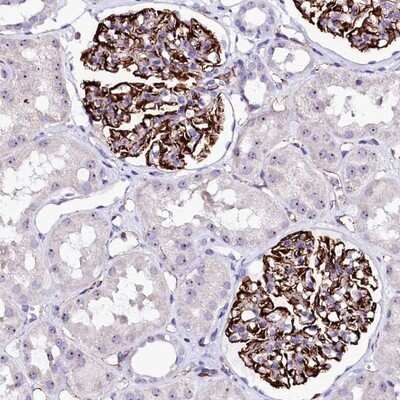 Immunohistochemistry-Paraffin: MEIR5 Antibody [NBP1-90797]