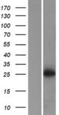 Western Blot: MEIR5 Overexpression Lysate [NBP2-05490]