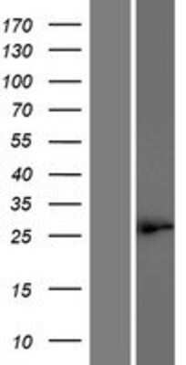 Western Blot: MEIR5 Overexpression Lysate [NBP2-08943]