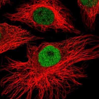 Immunocytochemistry/ Immunofluorescence: MEIS1 Antibody [NBP2-38776]