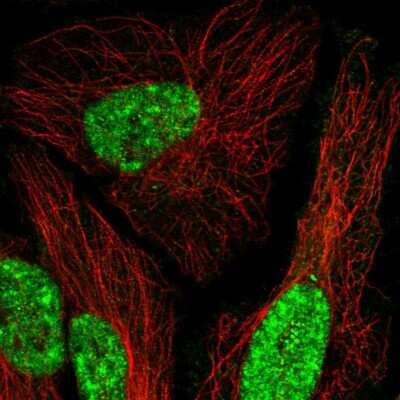 Immunocytochemistry/ Immunofluorescence: MEIS1 Antibody [NBP2-54930]