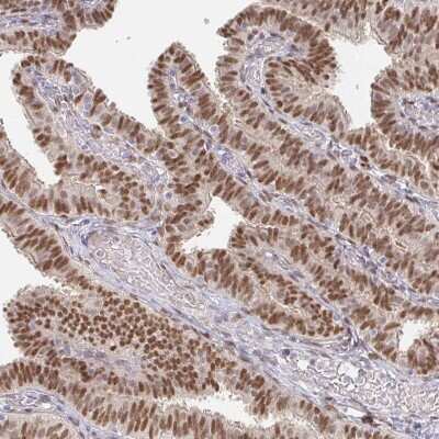 Immunohistochemistry-Paraffin: MEIS1 Antibody [NBP2-38776]