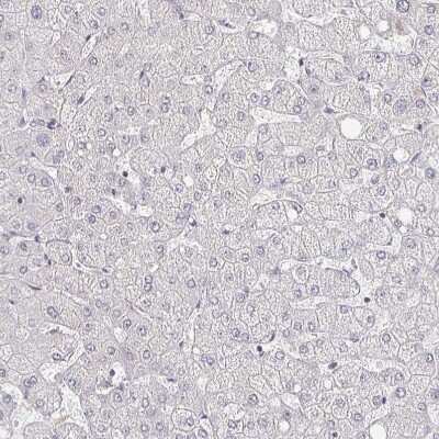 Immunohistochemistry-Paraffin: MEIS1 Antibody [NBP2-38776]