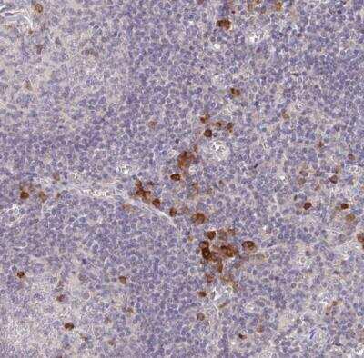 Immunohistochemistry-Paraffin: MEIS1 Antibody [NBP2-38776]