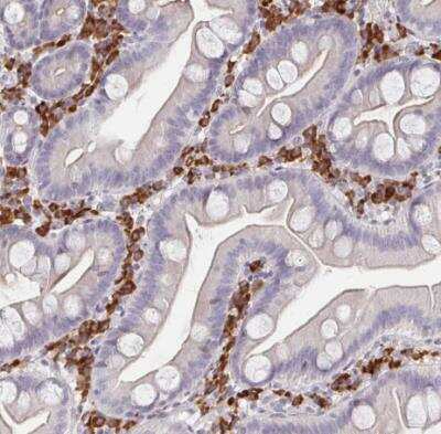 Immunohistochemistry-Paraffin: MEIS1 Antibody [NBP2-38776]