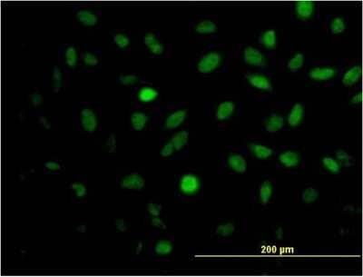 Immunocytochemistry/ Immunofluorescence: MEIS2 Antibody (1D1) [H00004212-M03]