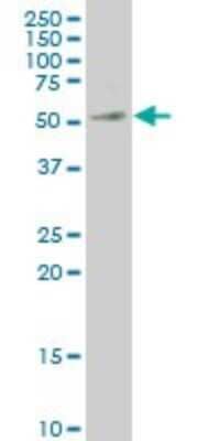 Western Blot: MEIS2 Antibody (1D1) [H00004212-M03]