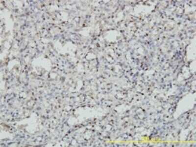 Immunohistochemistry-Paraffin: MEIS2 Antibody (1H4) [H00004212-M01]