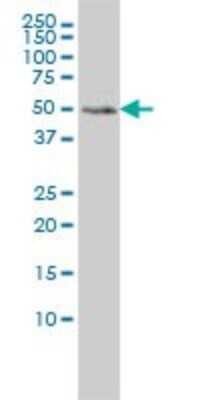 Western Blot: MEIS2 Antibody (1H4) [H00004212-M01]