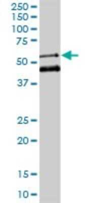 Western Blot: MEIS2 Antibody (1H4) [H00004212-M01]