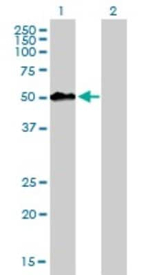 Western Blot: MEIS2 Antibody (1H4) [H00004212-M01]