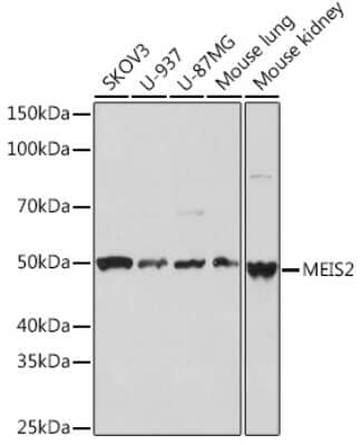 Western Blot: MEIS2 Antibody (2A6I3) [NBP3-16224]