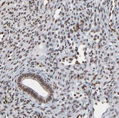 Immunohistochemistry-Paraffin: MEIS2 Antibody [NBP1-81669]