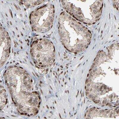 Immunohistochemistry-Paraffin: MEIS2 Antibody [NBP1-81669]