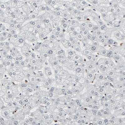 Immunohistochemistry-Paraffin: MEIS2 Antibody [NBP1-81669]