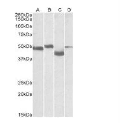 Western Blot: MEIS2 Antibody [NBP1-52041]