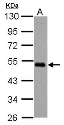 Western Blot: MEIS2 Antibody [NBP2-17263]