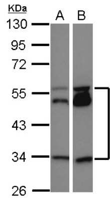 Western Blot: MEIS2 Antibody [NBP2-17263]