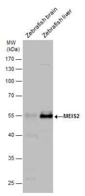 Western Blot: MEIS2 Antibody [NBP2-17263]