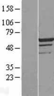 Western Blot: MEIS2 Overexpression Lysate [NBL1-13002]