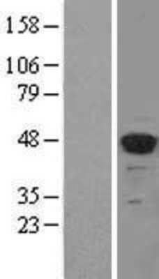 Western Blot: MEIS2 Overexpression Lysate [NBL1-13003]